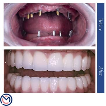 Slider image (7) Medicall Me